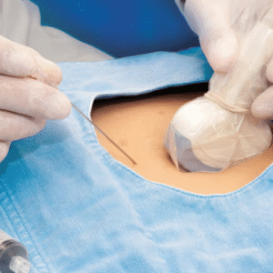 Surgiwear Ultrasound Drape - 15cm x 250cm (D 905)